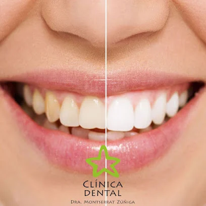Dra. Montserrat Zúñiga Clínica Dental en Tarragona