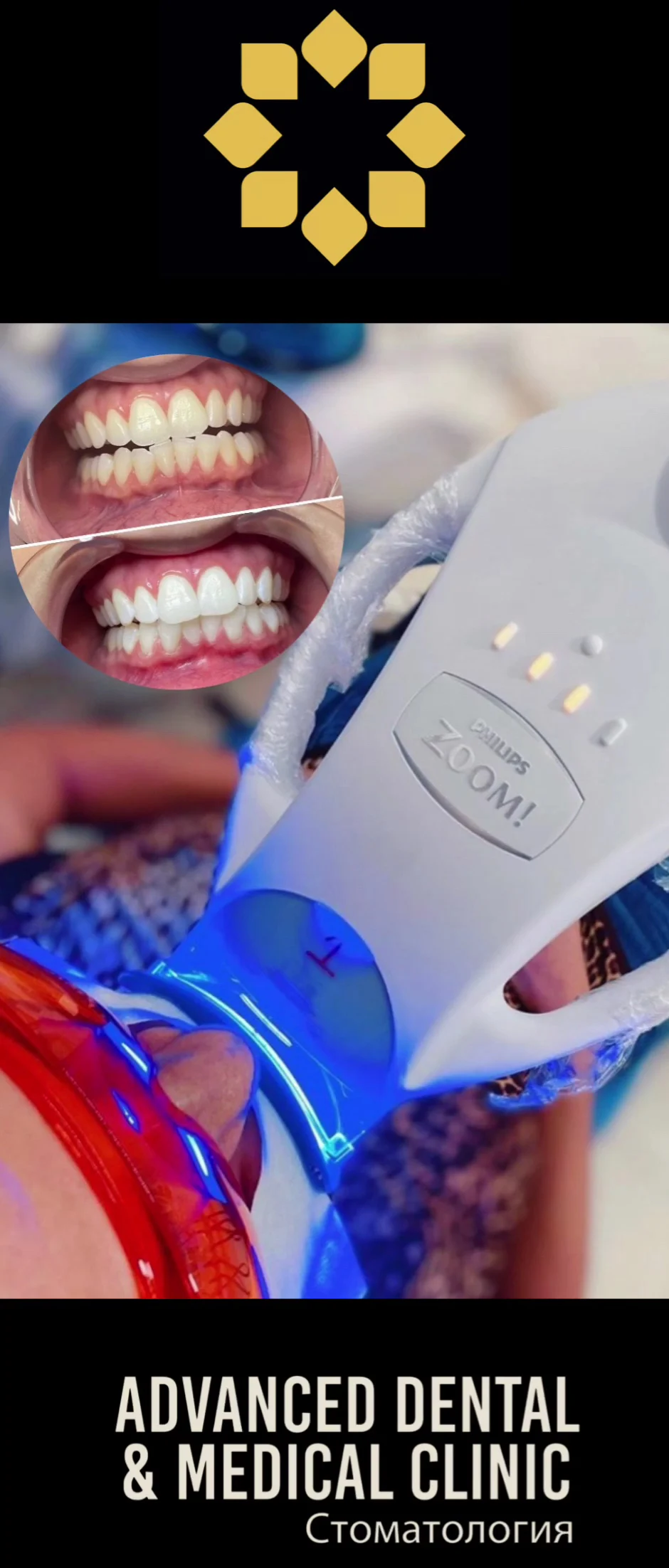 Advanced Dental & Medical Clinic · Implantes, Carillas, Alineadores Invisalign · English & Russian spoken - 3
