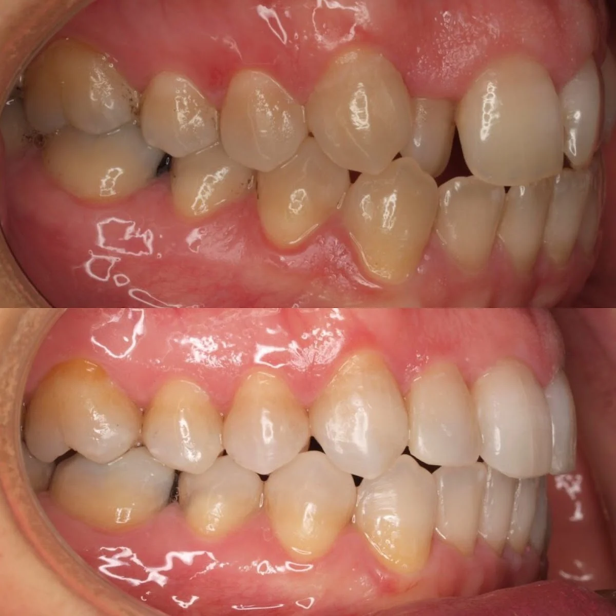 AE clínica estética dental Barcelona - 2