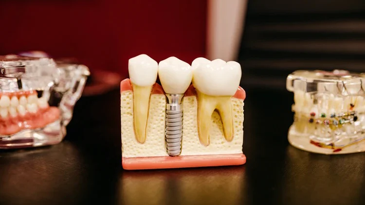 alvarez clínica dental LLORET DE MAR