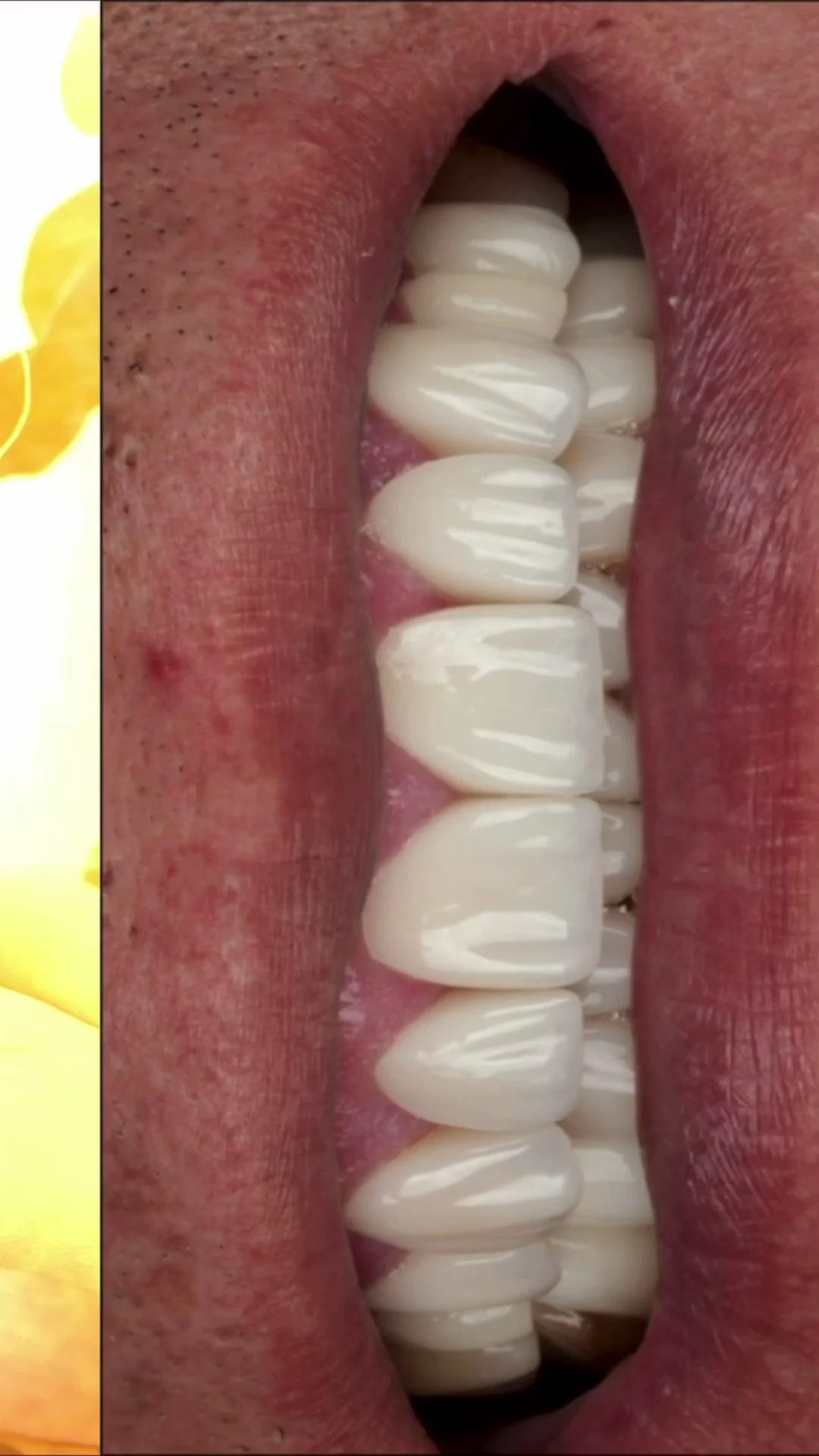 Ame dental studio | Carillas Dentales | Blanqueamiento Dental | Implantes Dentales | Ortodoncia - 2
