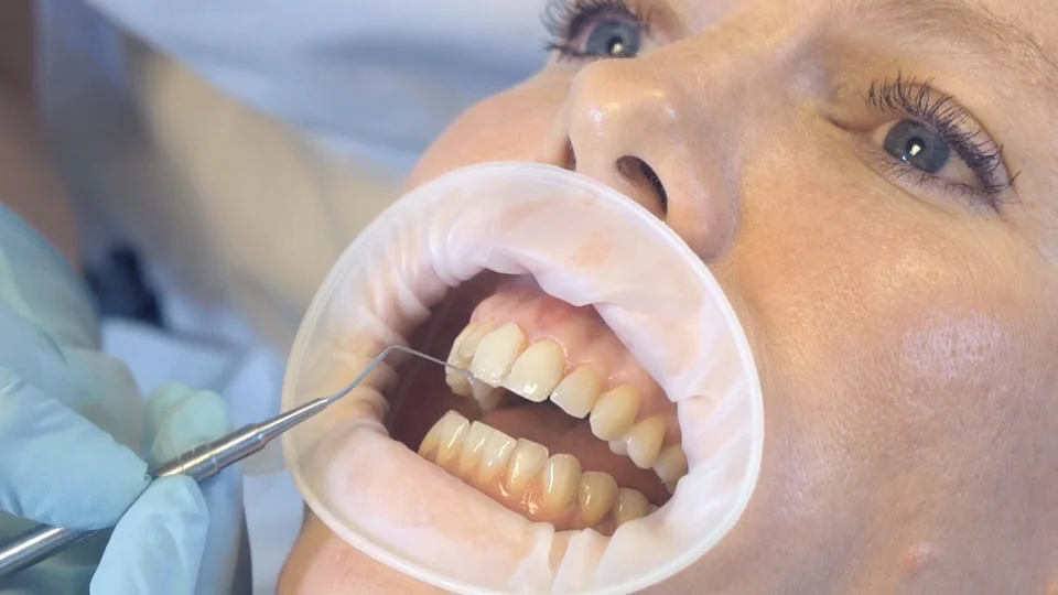 Ana Cabeza Dentista Majadahonda Estética dental - 2
