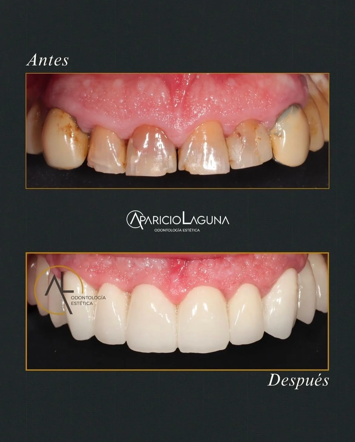 Aparicio Laguna - Clínica Dental - 2