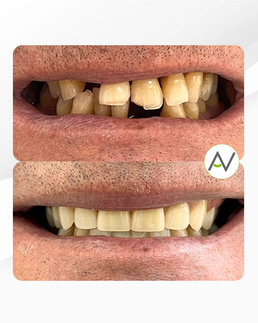 AVILÉS Clínica Dental - 2