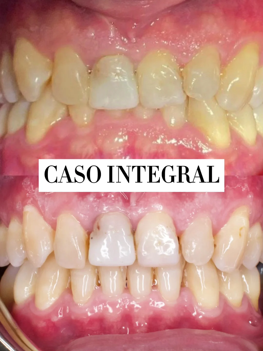 AVILÉS Clínica Dental - 3