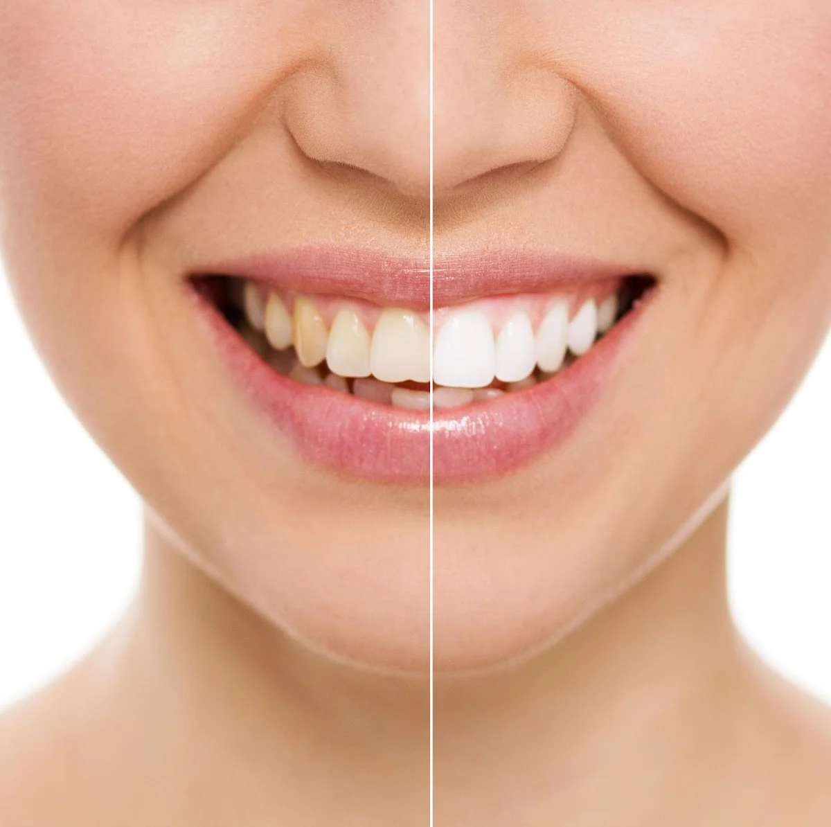BONESTAR CLÍNICA DENTAL - 3
