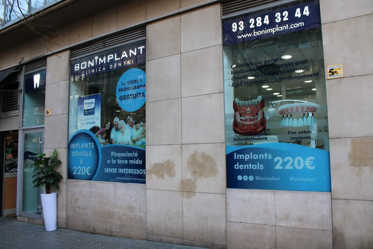 Bonimplant - 2