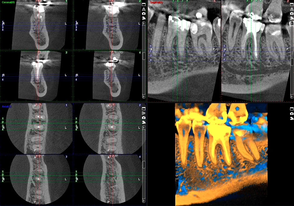 C3D PALMA MALLORCA - CENTRO DE DIAGNOSTICO AVANZADO (ODONTOLOGÍA DIGITAL) - 2