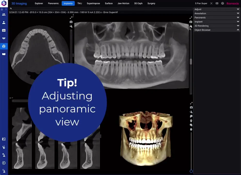 C3D PALMA MALLORCA - CENTRO DE DIAGNOSTICO AVANZADO (ODONTOLOGÍA DIGITAL) - 3