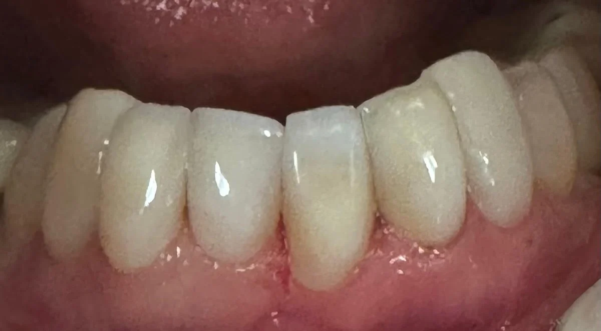 Calpe Dental - 2