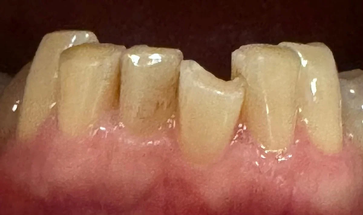 Calpe Dental - 3