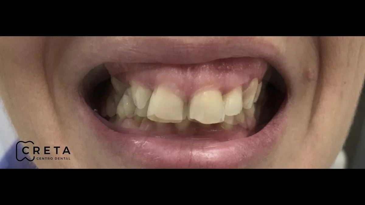 Centro Dental Creta (Av. Príncipe Felipe, 21) - 2