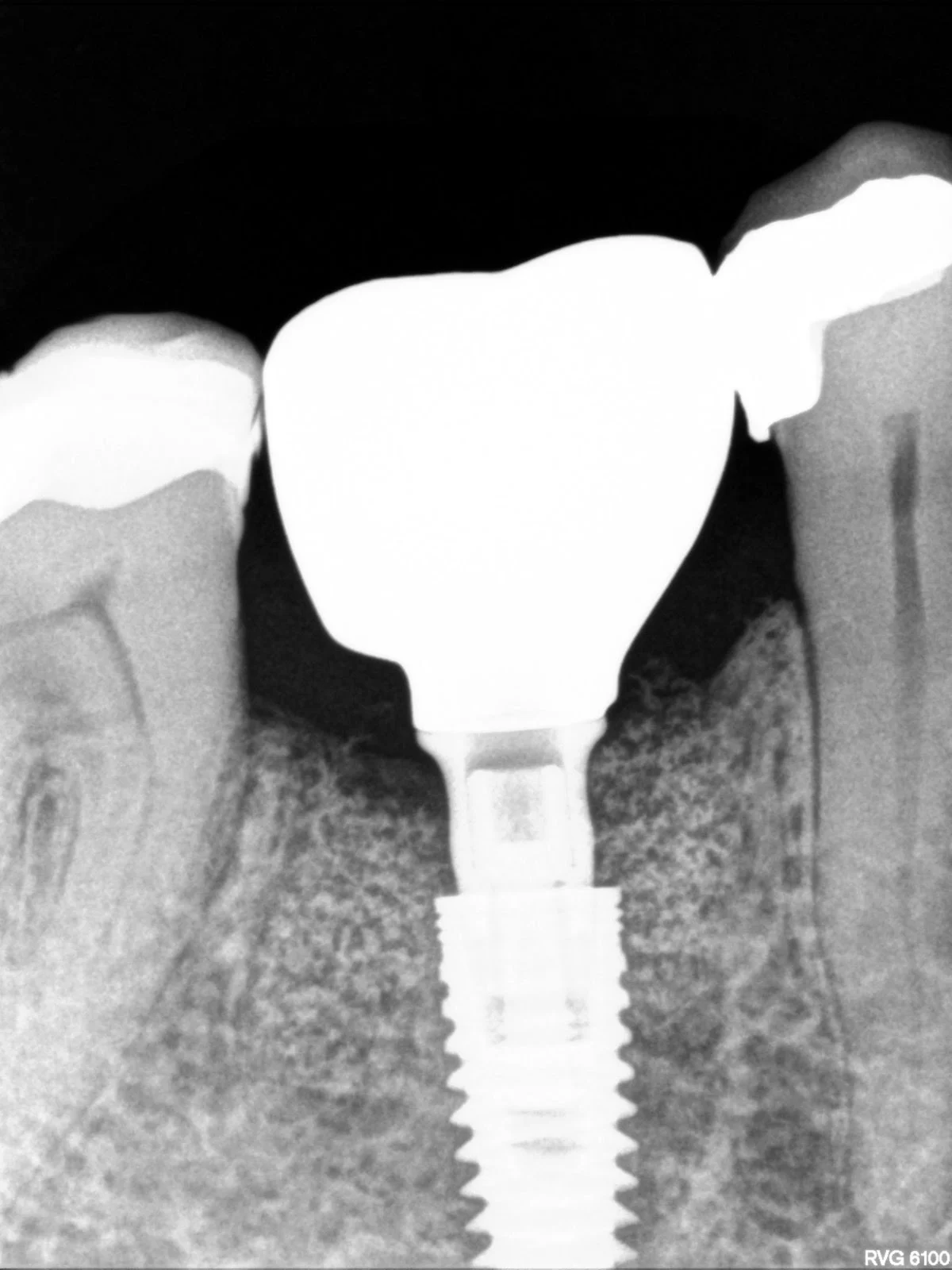 Centro Dental Navarro Ferri - 3