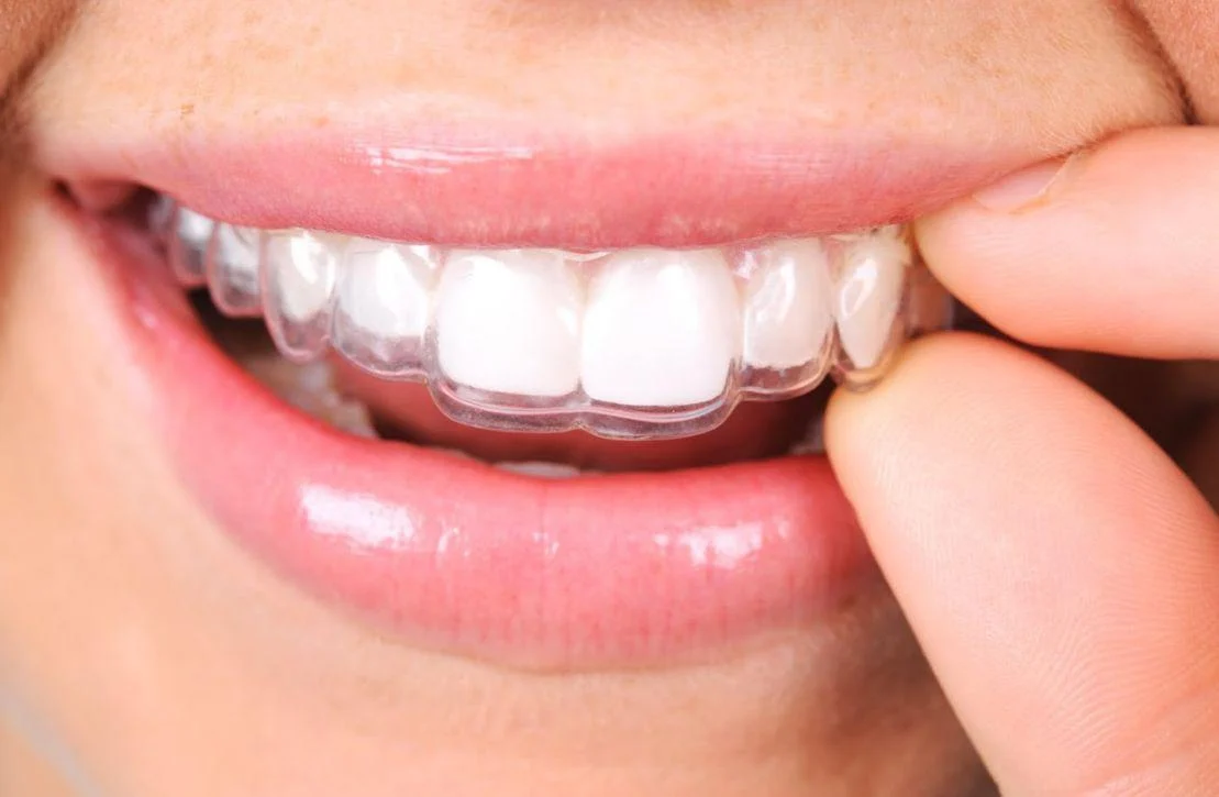 CEO Clínica Dental - 3