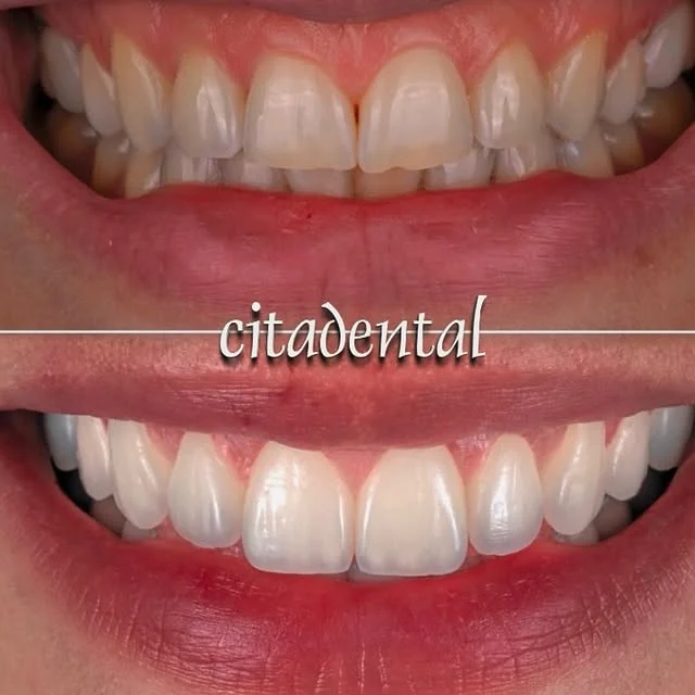 CITADENTAL Bravo Murillo - 2