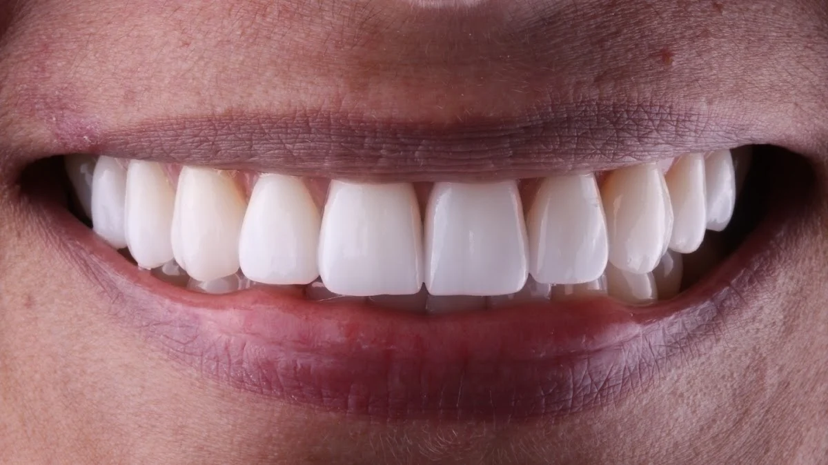 Clinica Dental Aarvo Suisse