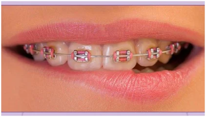 Clínica Dental Angela Pla