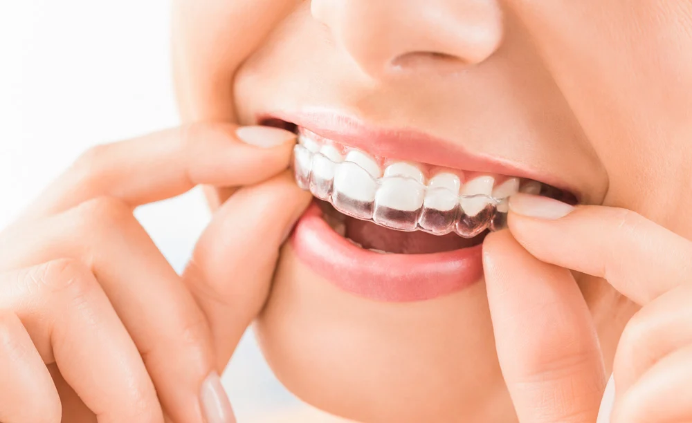 Clínica Dental ARAVACA y POZUELO | Doctores Chabani - 2