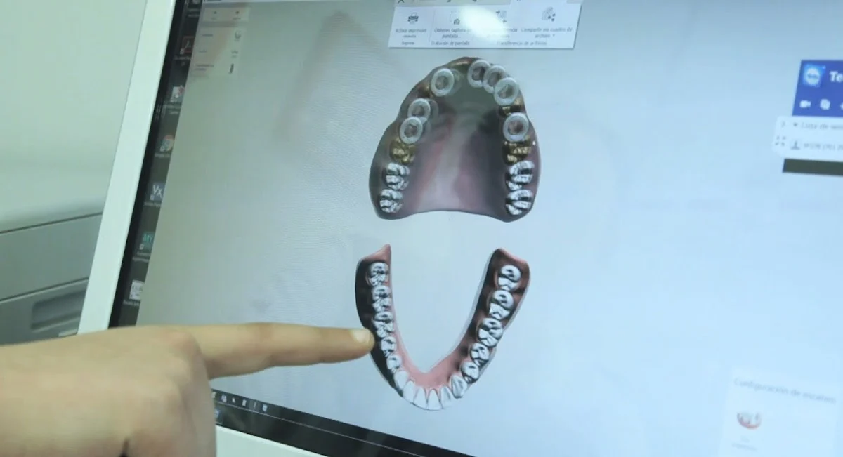 Clínica Dental ARAVACA y POZUELO | Doctores Chabani - 3