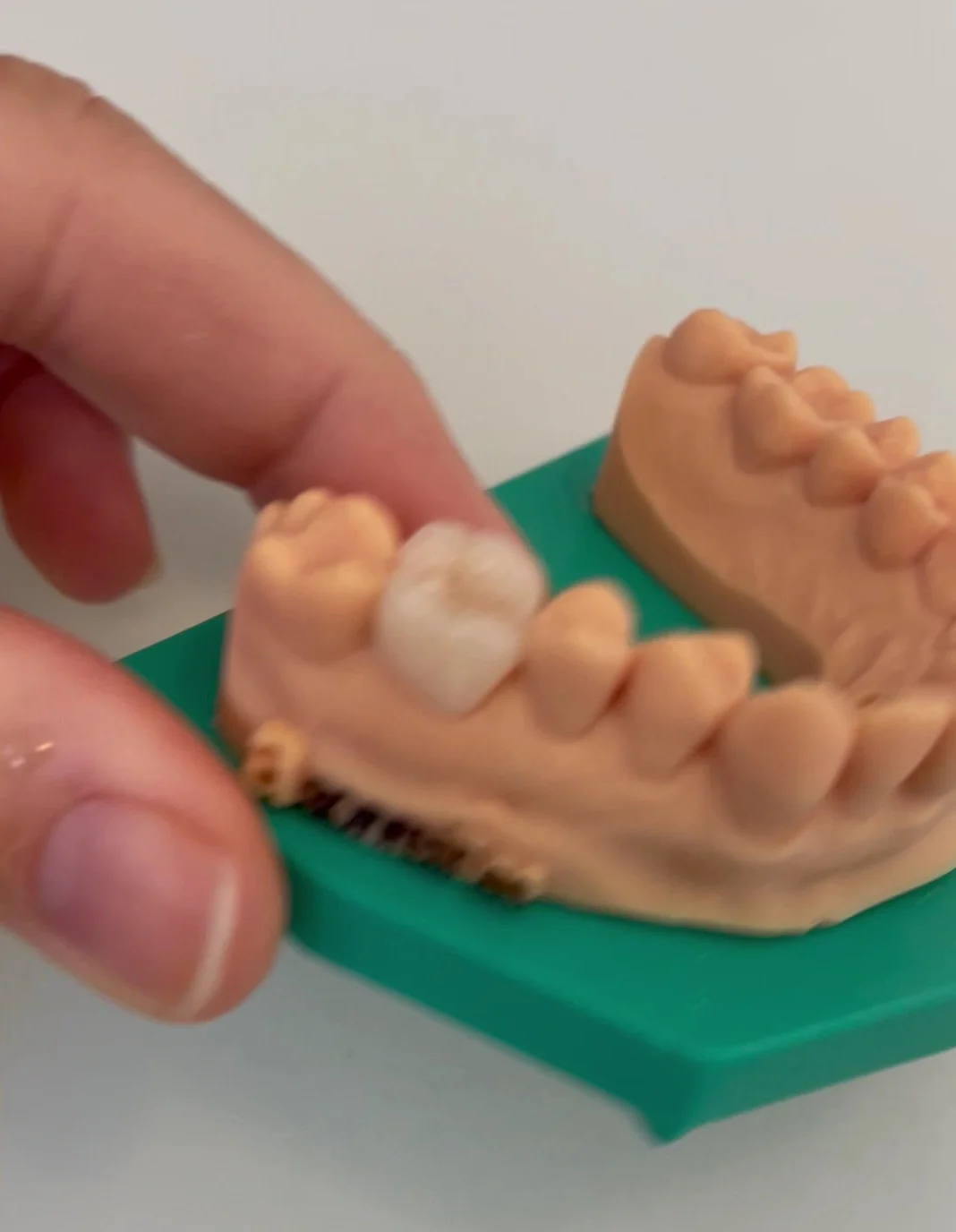 Clínica Dental ASonreir Chiclana Cádiz - 2