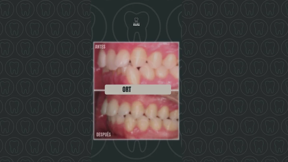 Clínica Dental Atocha. Ortodoncia e Implantes Dentales Madrid - 3