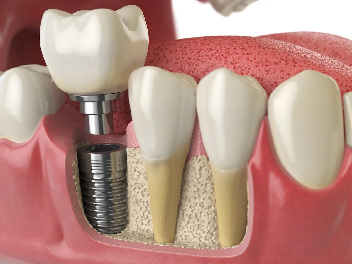Clinica Dental Bahia