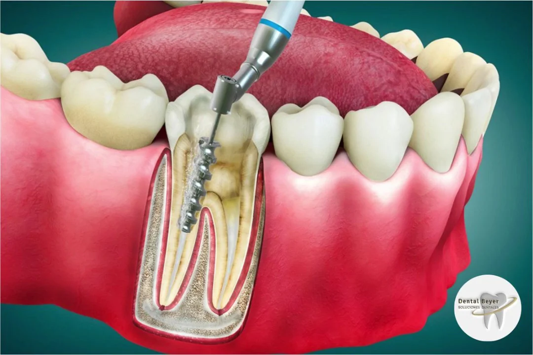 Clinica Dental Beyer - 3