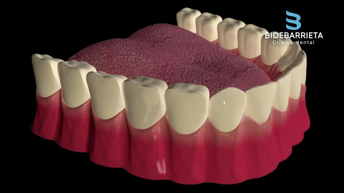 Clínica Dental Bidebarrieta - 2