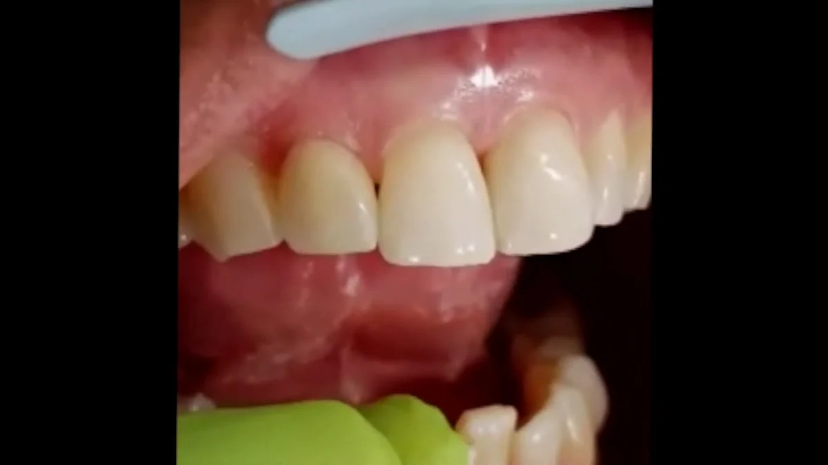 Clínica Dental BIOCARE - 3