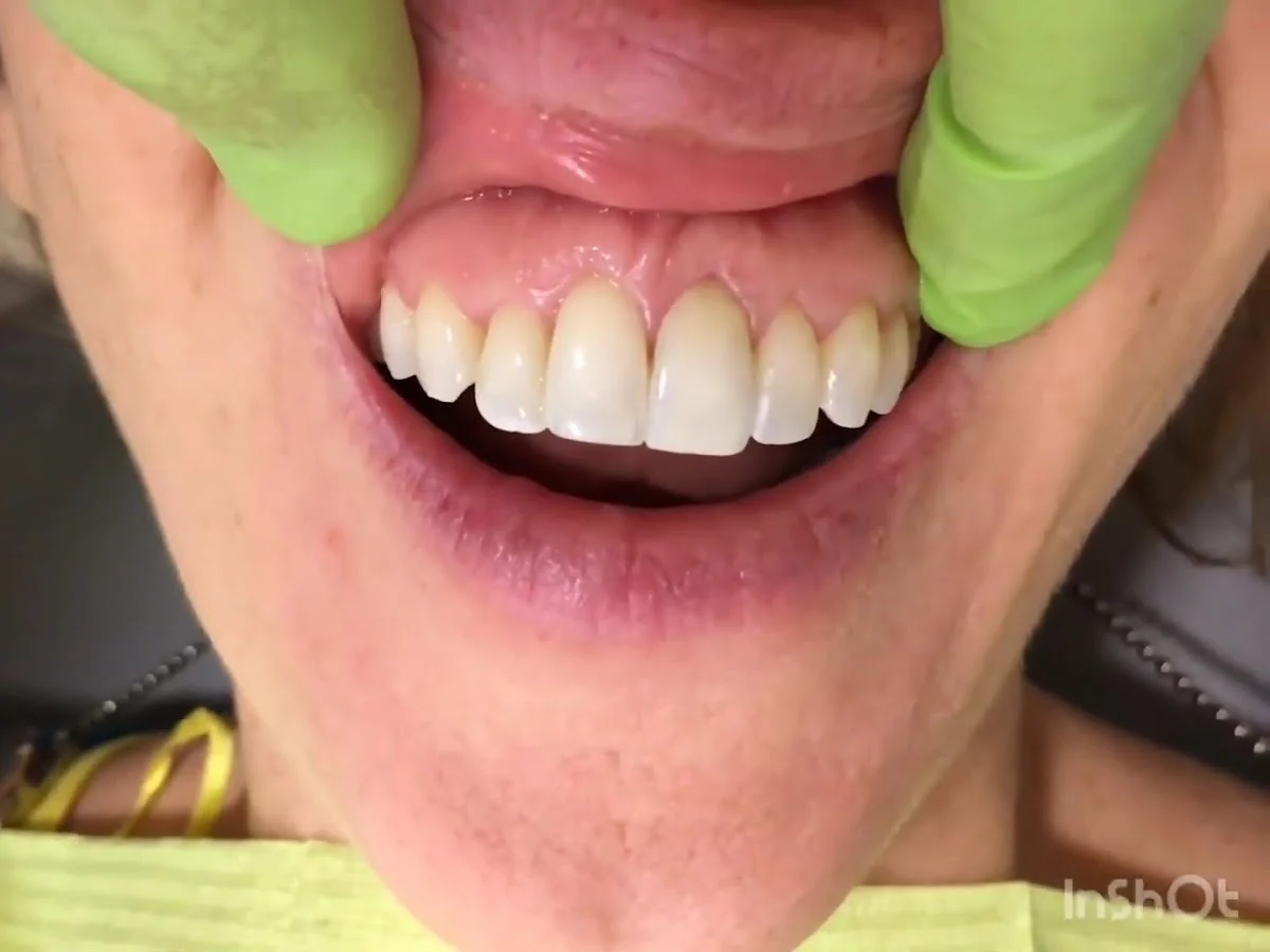 Clínica Dental BIOCARE - 4