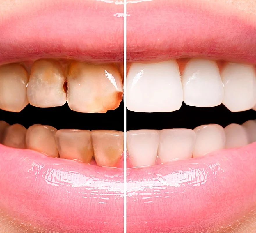 Clínica Dental Boccabell - 3