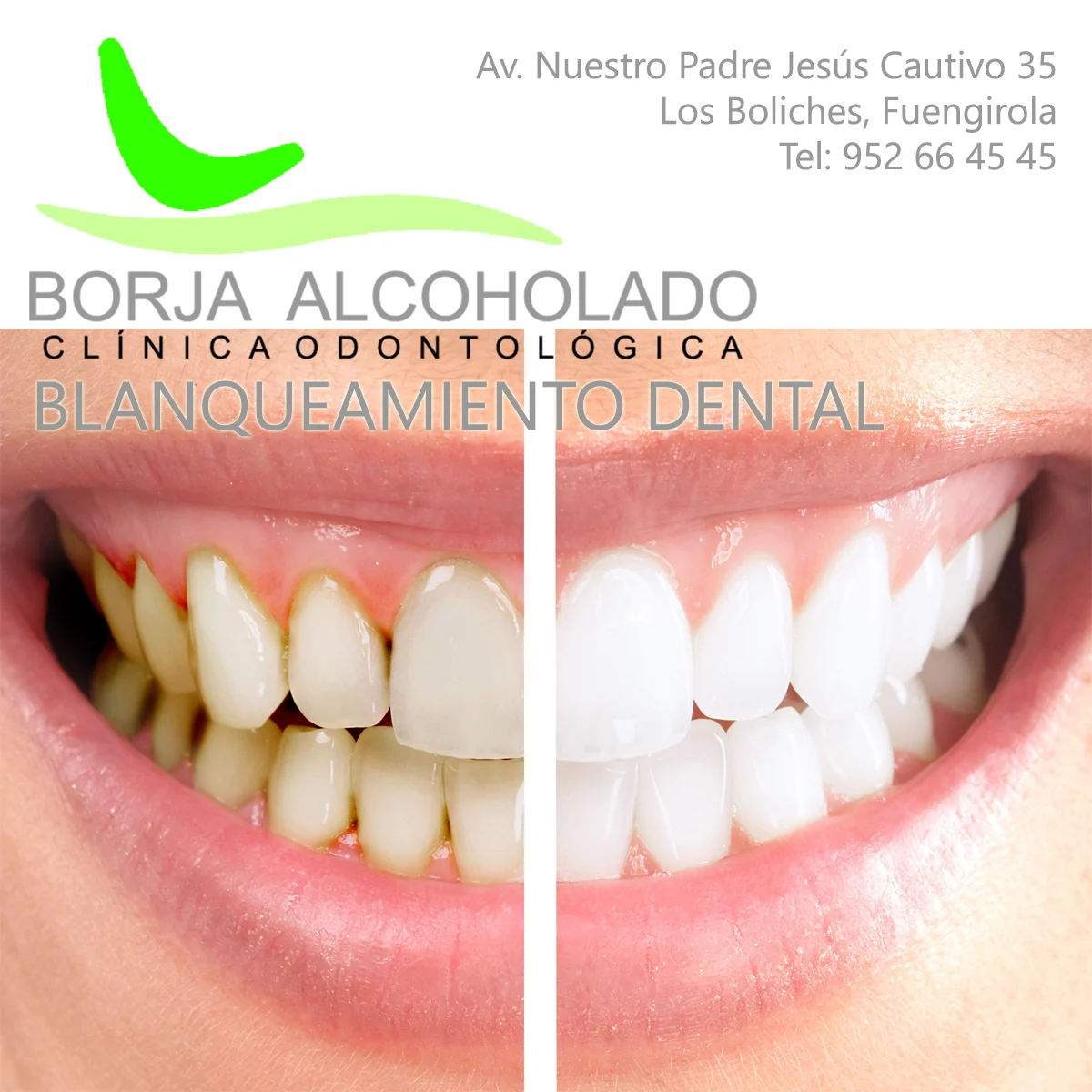 CLINICA DENTAL BORJA ALCOHOLADO - 2