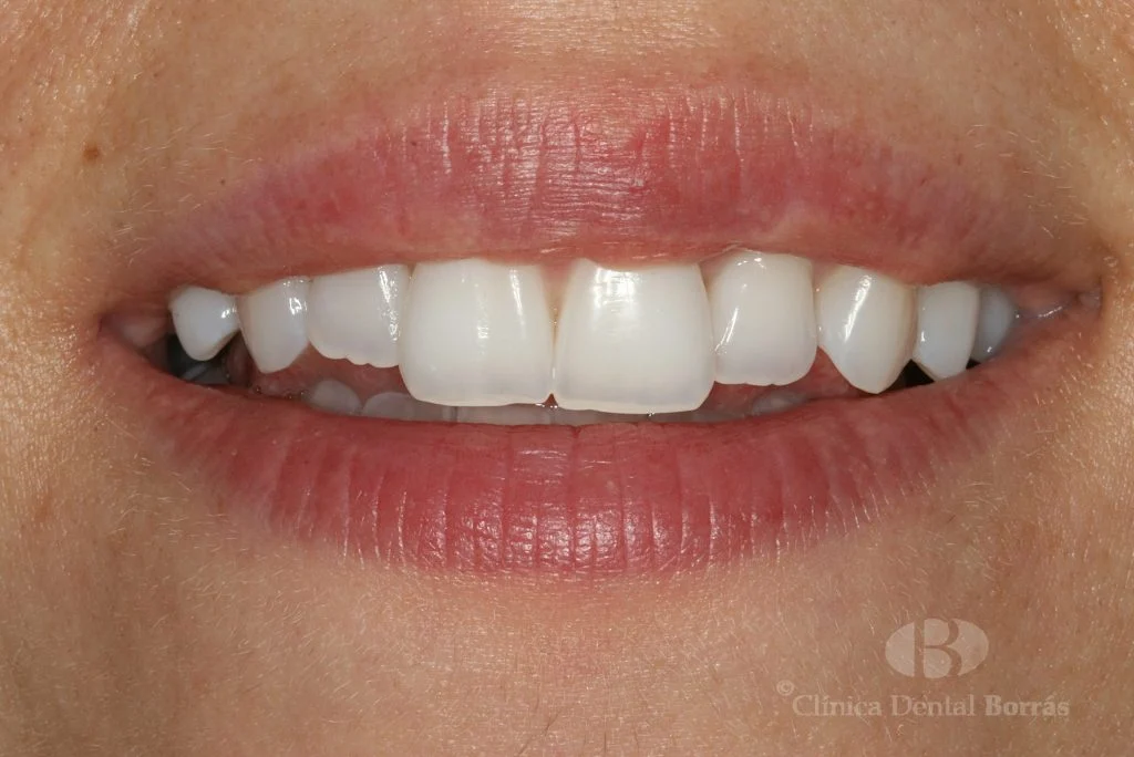 Clínica Dental Borrás - 2