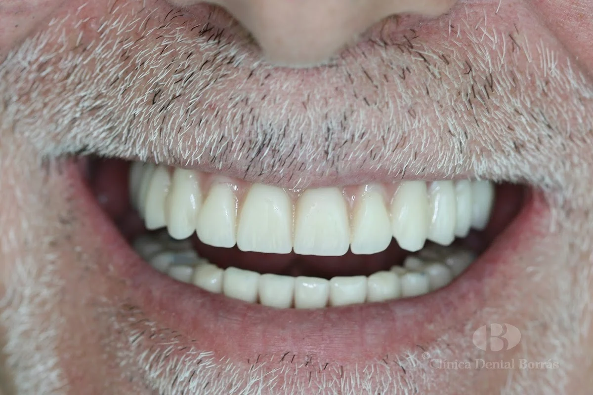 Clínica Dental Borrás - 3