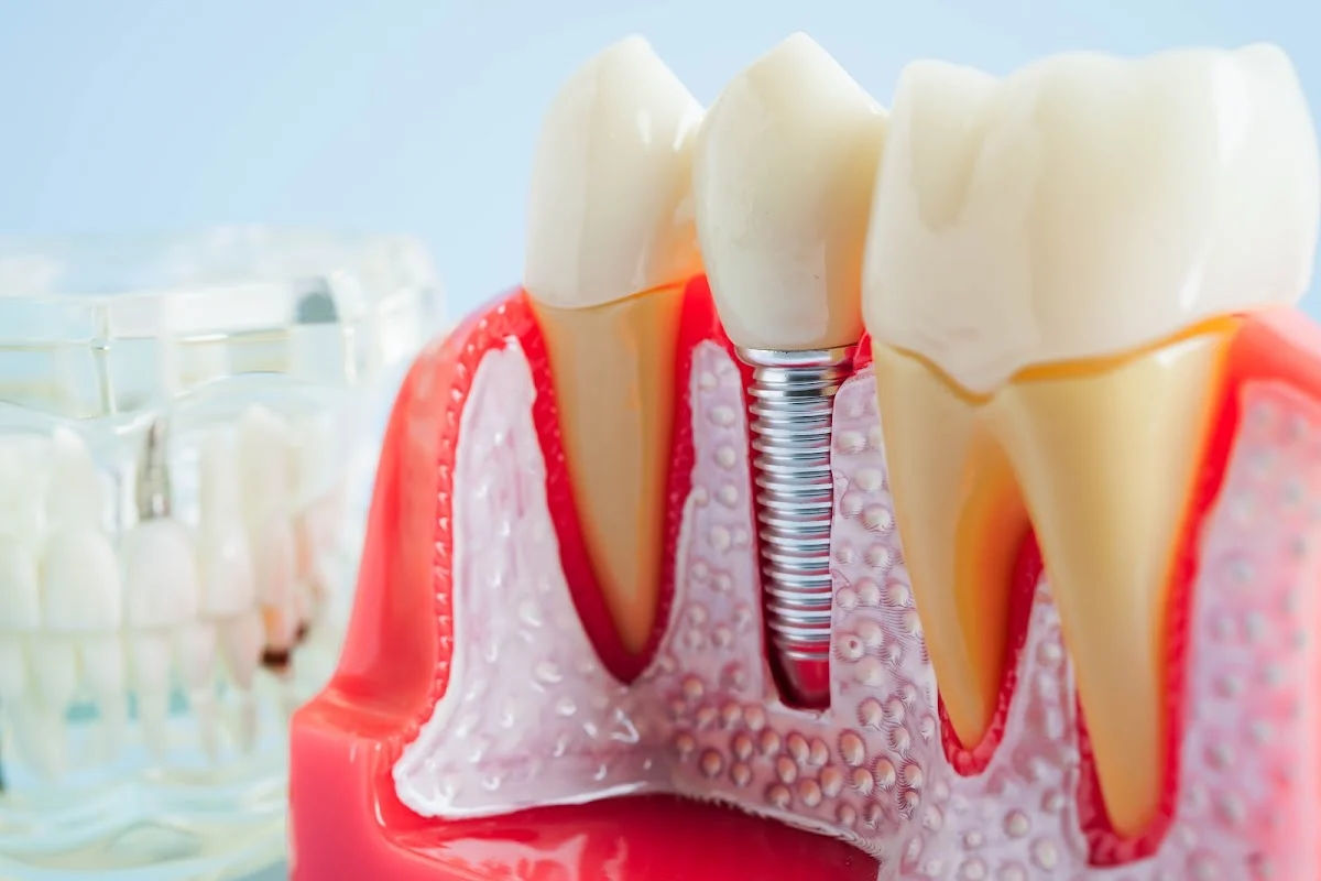 Clínica Dental Busto Gómez - 2