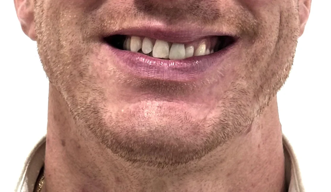 Clínica Dental Carabanchel TH - 2