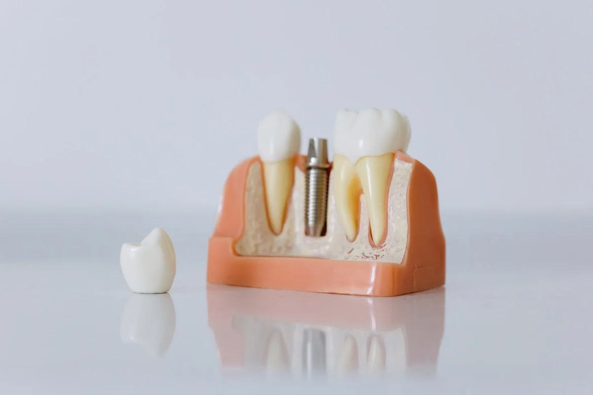 Clínica Dental Care Sabadell - 2