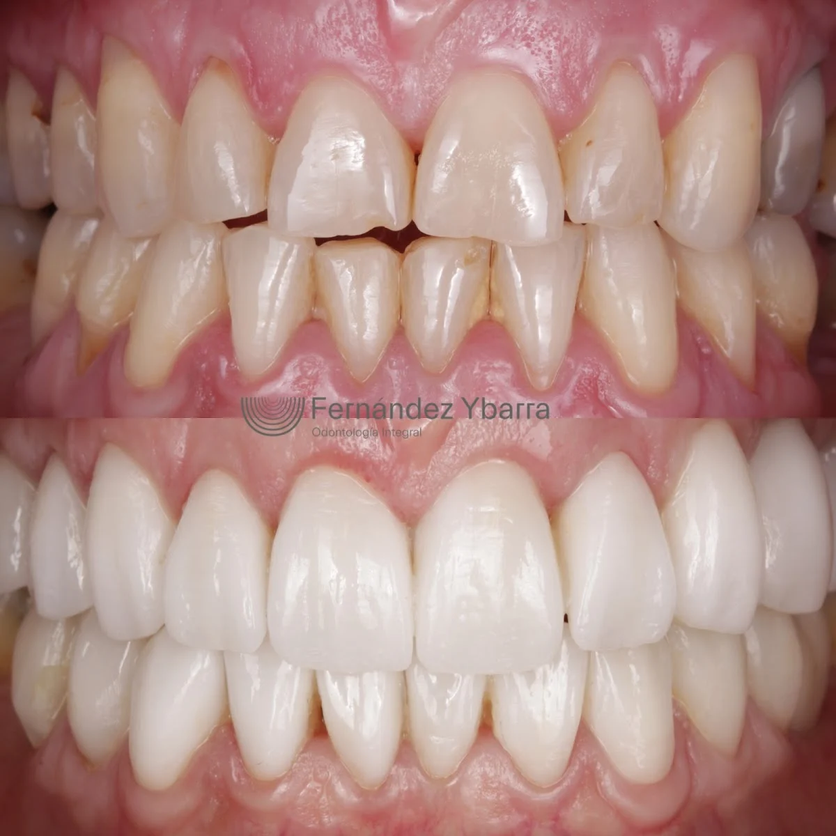 Clínica Dental Castellón | Fernández Ybarra - 2
