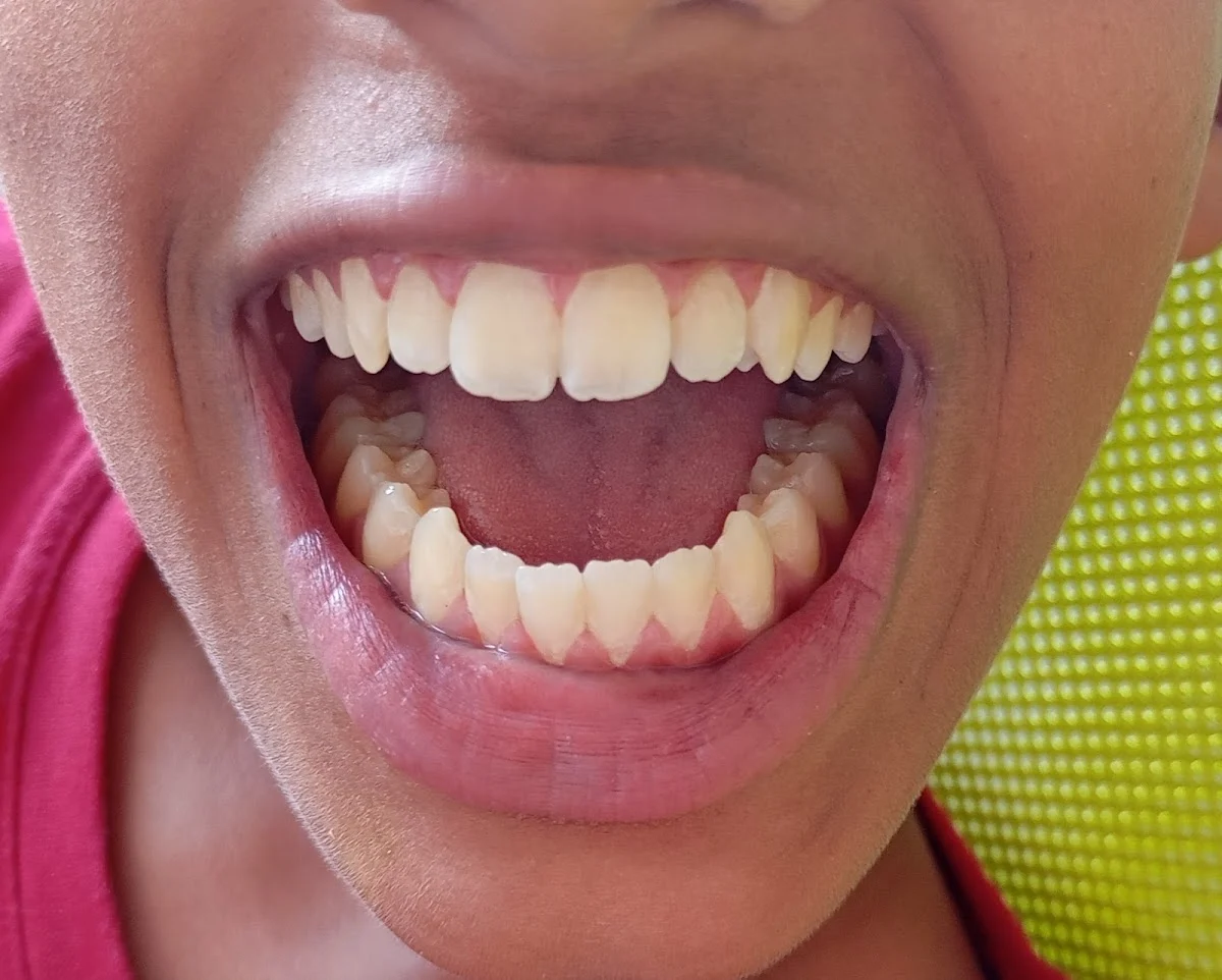 Clínica Dental CAXAL Zaragoza. Ortodoncia y Odontopediatría - 2