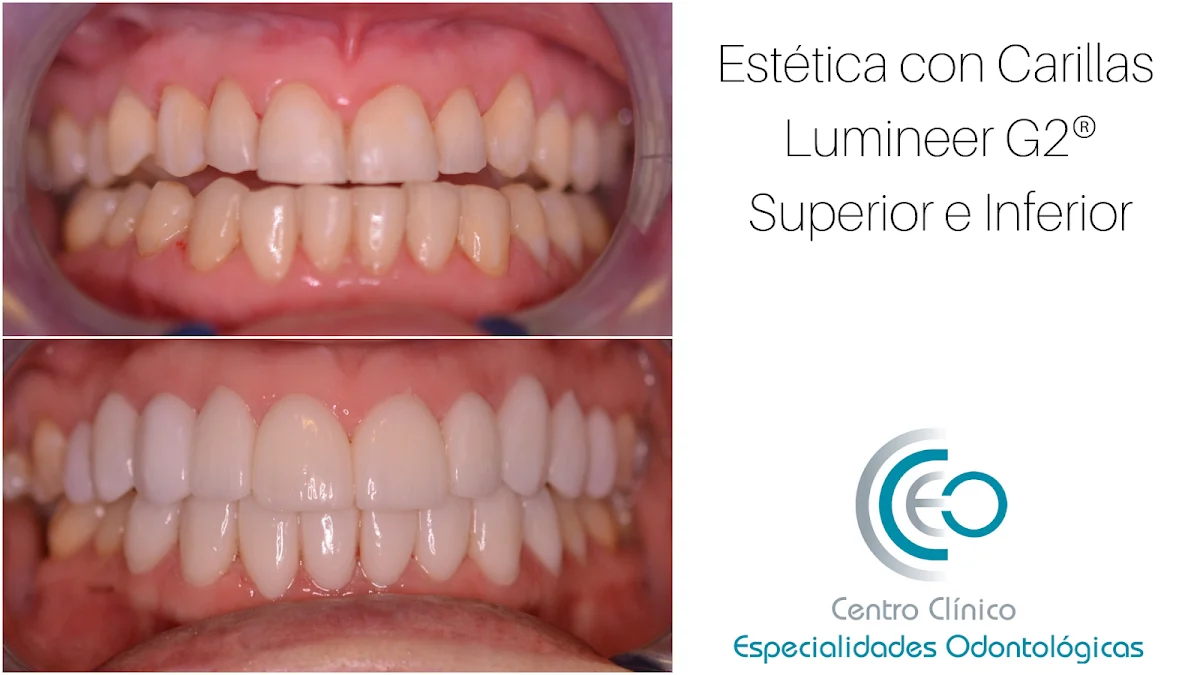 Clinica Dental CCEO - 2