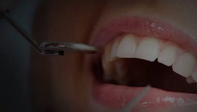 Clinica Dental Chela Balaguer | Clinica Chela Implantologia - 2