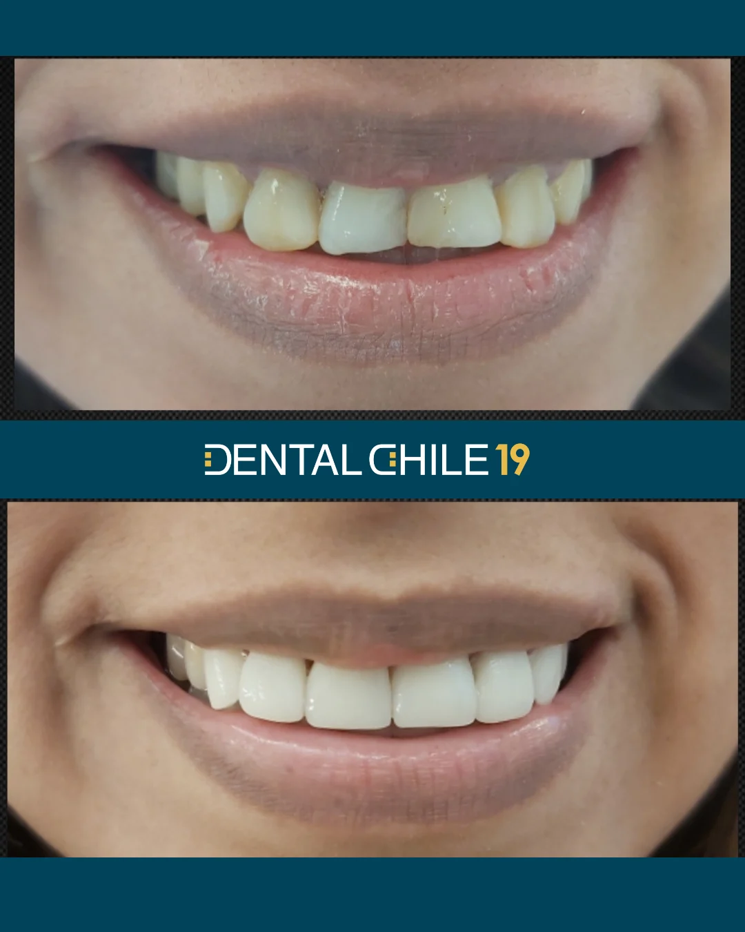 CLÍNICA DENTAL CHILE - 2