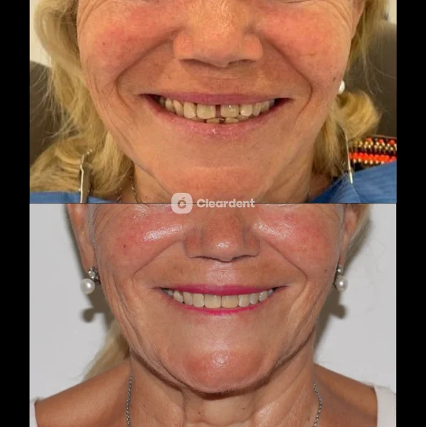 Clínica Dental Cleardent Córdoba - 2