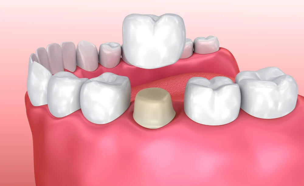 Clínica Dental Cornudella - 2