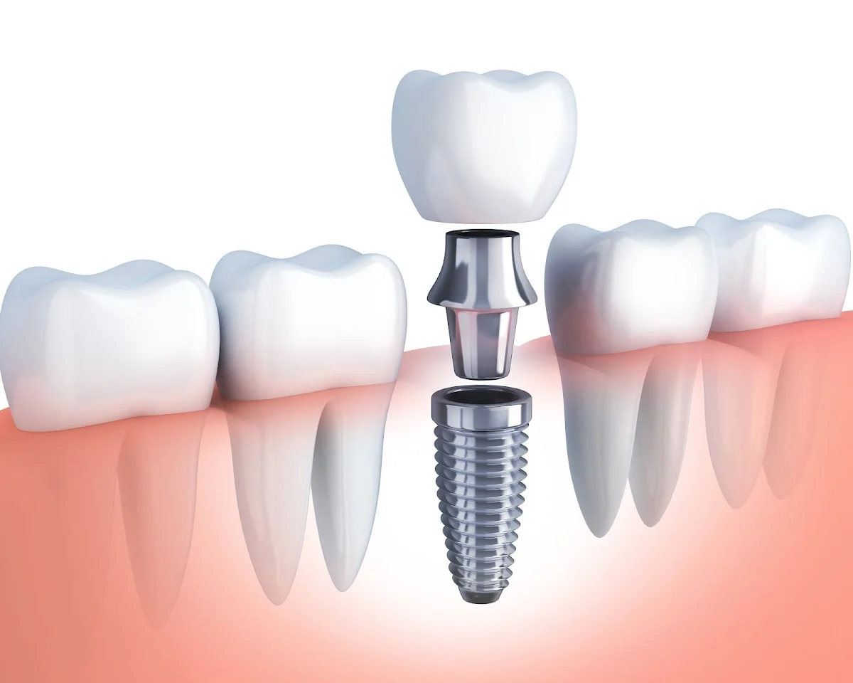 CLÍNICA DENTAL DELICIAS - 2