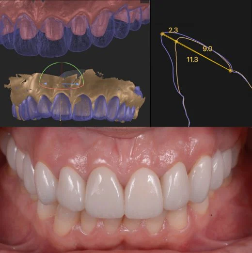 Clínica Dental DEN Barcelona - 2