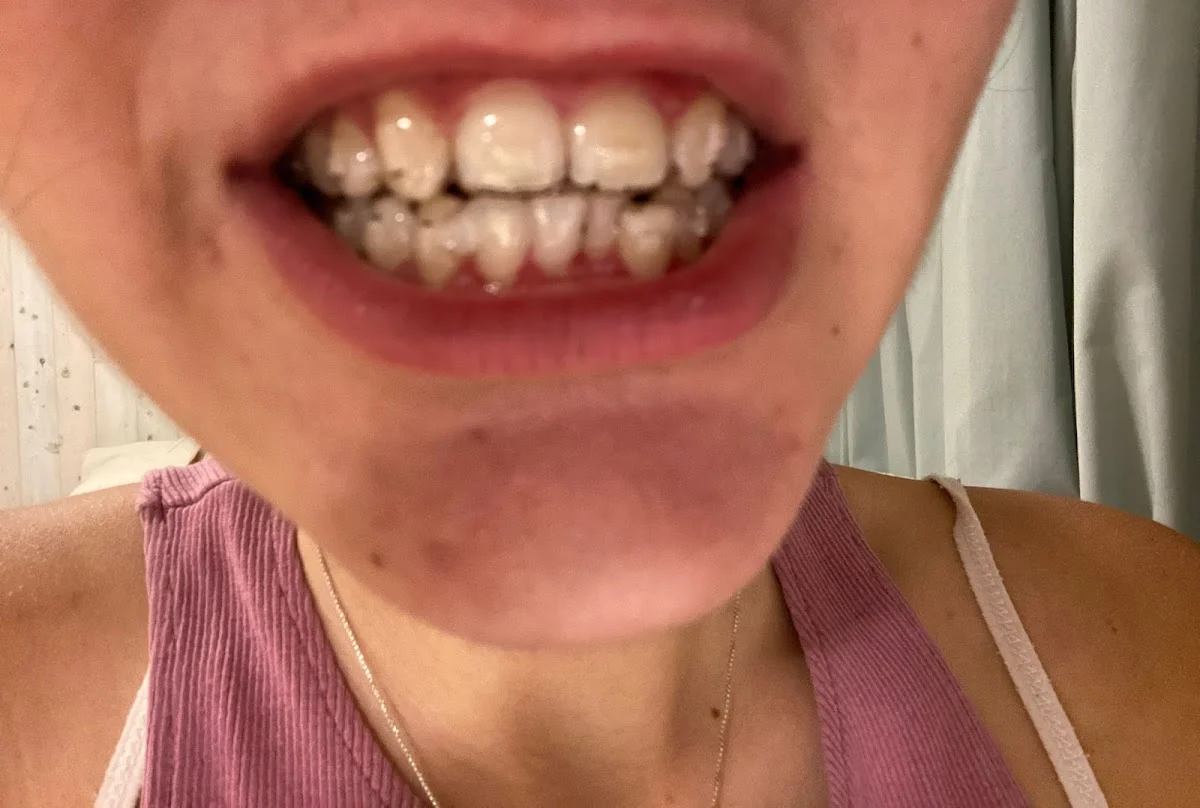 Clínica dental Diseño Sonrisa Roquetas y Almería - Dentista Roquetas De Mar - 2