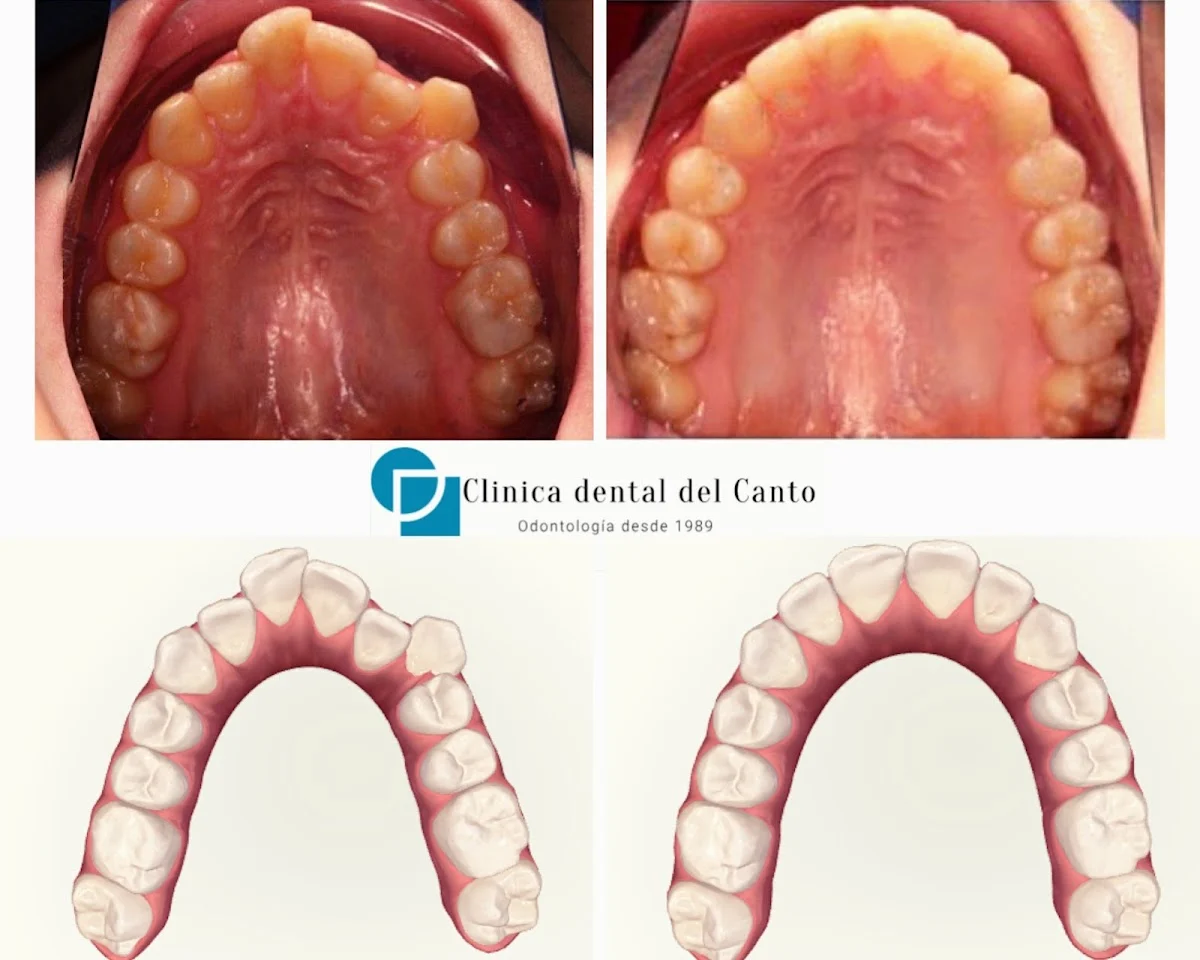 Clinica Dental Doctor Cirilo Del Canto - 2