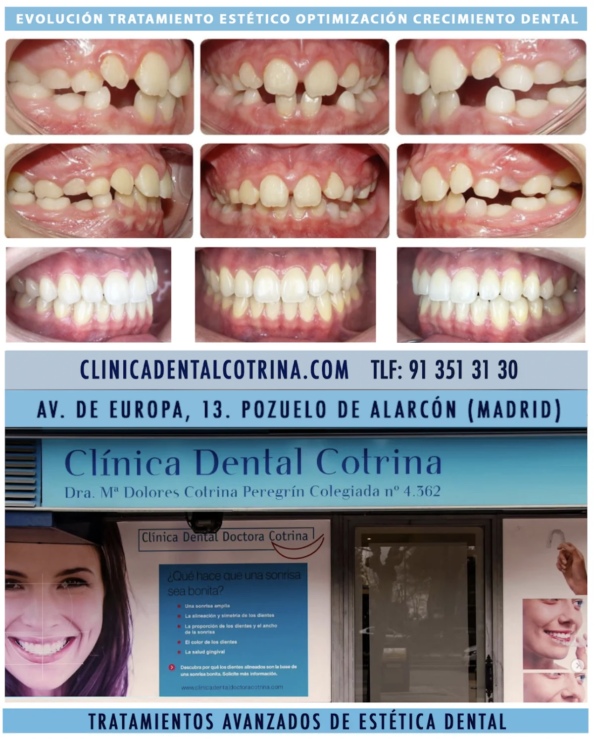 Clínica Dental Doctora Cotrina Dentistas en Pozuelo de Alarcón.