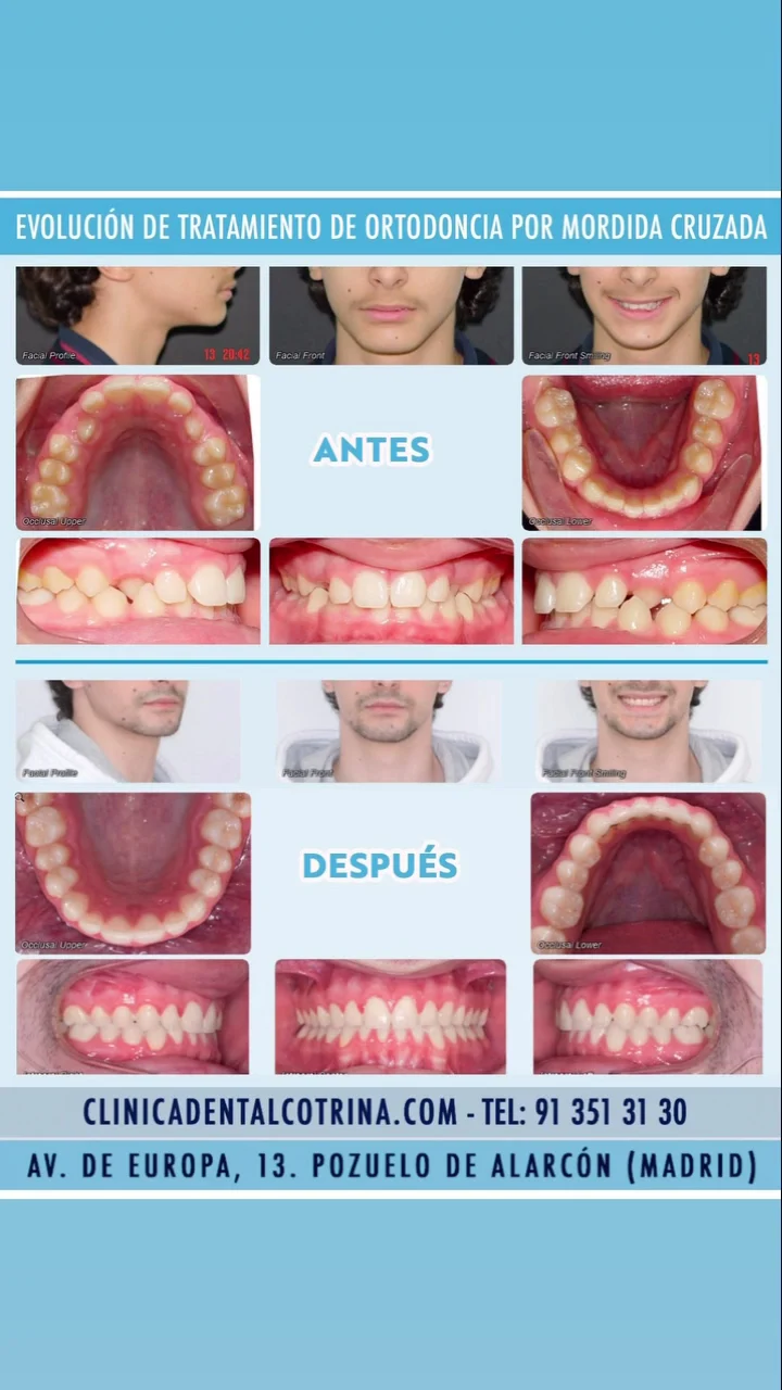 Clínica Dental Doctora Cotrina Dentistas en Pozuelo de Alarcón. - 2